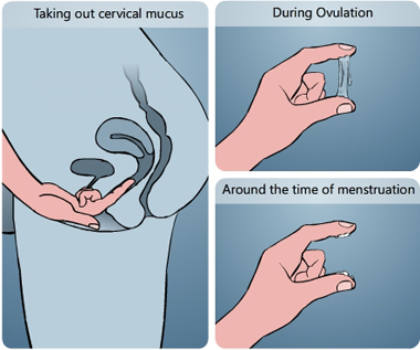 Illustration of taking out cervical mucus by inserting a finger in the vagina and analysing it between the index finger and the thumb, during ovulation the mucus is slippery and transparent, around the time of menstruation the mucus is white and sticky - Menstrupedia