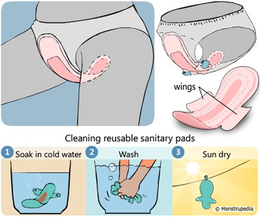 Illustration of how a sanitary pad is worn in the panty and washing instructions for cleaning a reusable cloth pad, soak in cold water, wash, sun dry - Menstrupedia