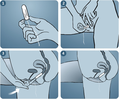 Illustration of steps showing the usage of tampon without applicator, step 1: the base of the tampon is held between the index finger and the thumb, step 2: The tampon is inserted in the vagina while keeping the legs spread apart, step 3: The tampon is gently pushed inside the vagina using the middle finger, step 4: The finger is removed while the string of the tampon is left hanging - Menstrupedia