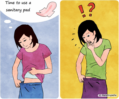 Illustration of two girls who have just found that they have got their first period(Menarche). One of the girl is calm as she knows that it is her period and she needs to wear a sanitary pad where as the other girl is perplexed as she has no clue why blood is coming out of her vagina - Menstrupedia
