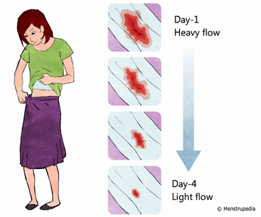 long menstrual bleeding