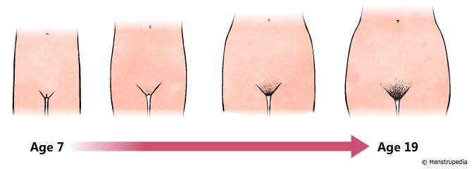 illustration of widening of hips and growth of pubic hair during puberty in girls from age 7 to age 19 - Menstrupedia